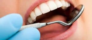 A close up of a woman's mouth with a tooth brush.