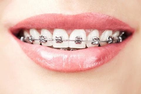 orthodontics lancashire
